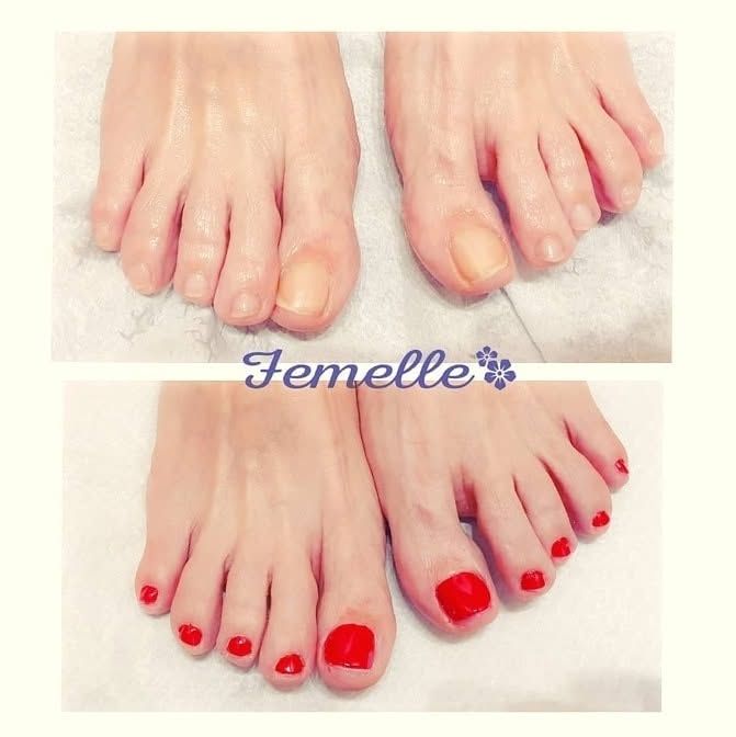 Due foto di piedi, una con unghie naturali e una con pedicure rosso acceso, etichettate “Femelle”