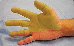 A close up of a person 's hand with yellow and orange fingers.