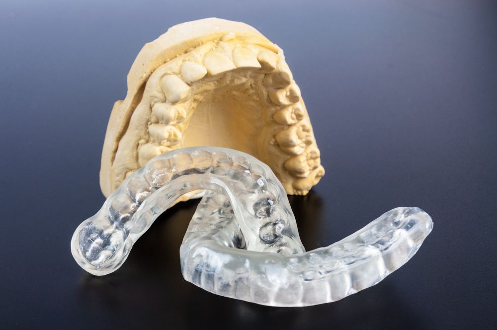 Clear Dental Mouth Guard Next to a Plaster Dental Mold on a Dark Surface — Trinity Beach Dental In Trinity Beach, QLD