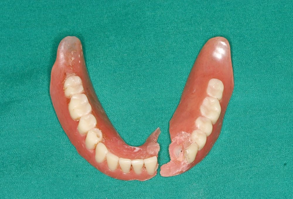 Broken Dentures on a Green Surface. Pink Plastic With White Artificial Teeth — Trinity Beach Dental In Trinity Beach, QLD