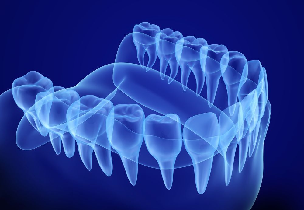 X-ray of Human Teeth in Blue, Showing Upper and Lower Jaws — Trinity Beach Dental In Trinity Beach, QLD