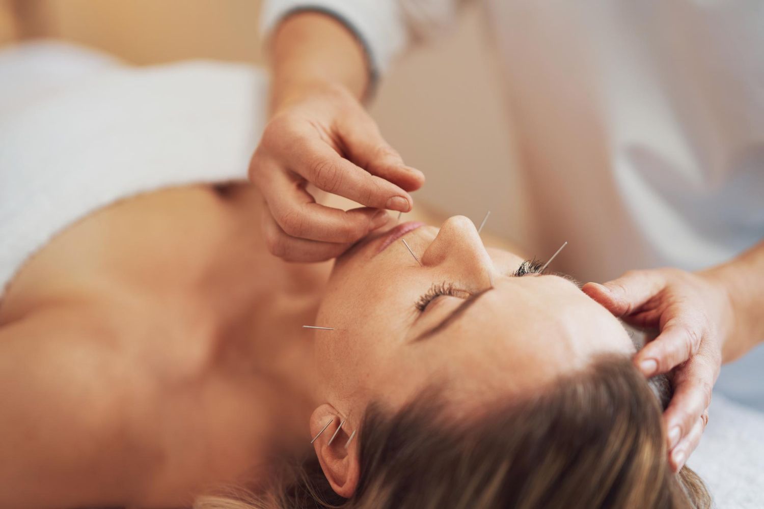 A practitioner performs facial acupuncture on a person lying down, inserting thin needles into the skin.