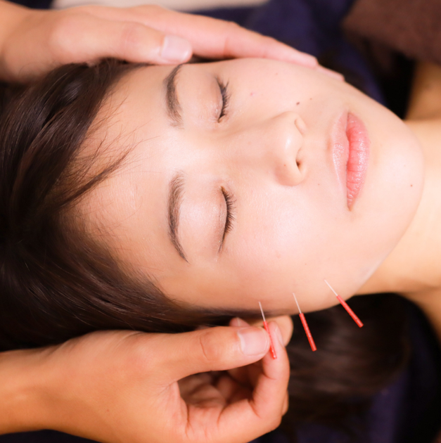 Rediscover Radiance Through Cosmetic Acupuncture