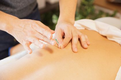 A practitioner inserts a thin acupuncture needle into the upper back of a person lying on a massage table.