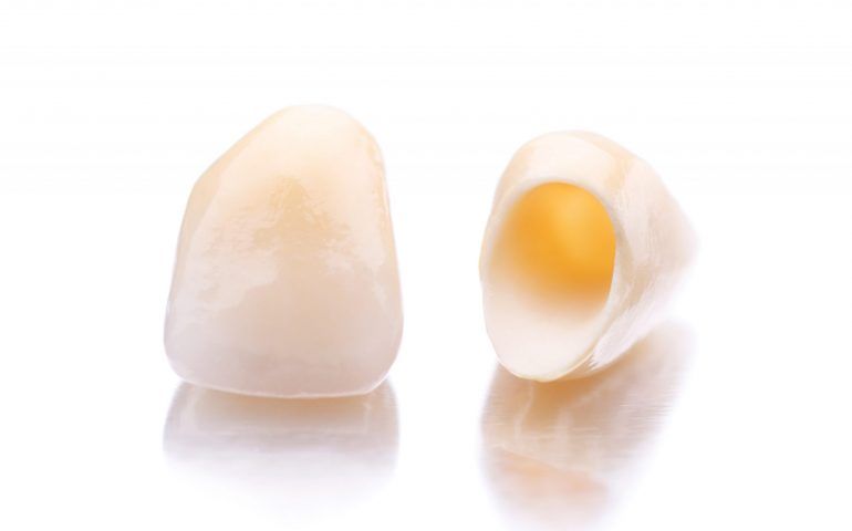 Crown Lengthening