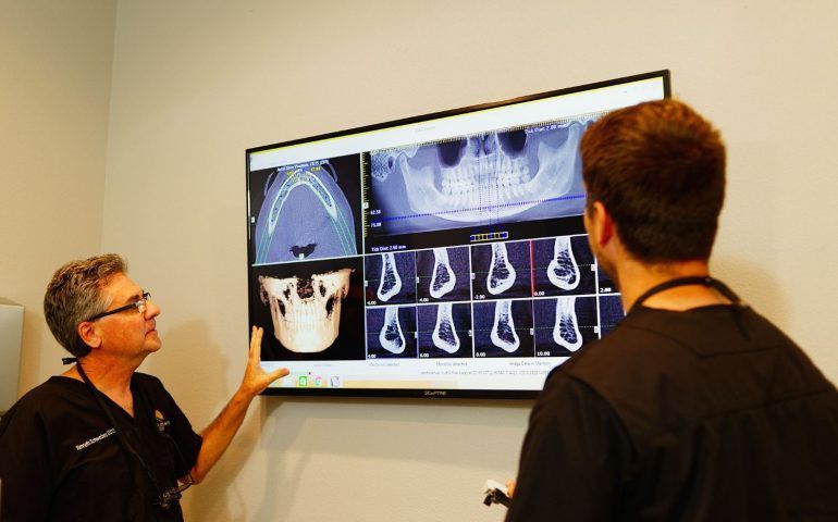 Multiple Tooth Extractions Multiple Tooth Extractions
