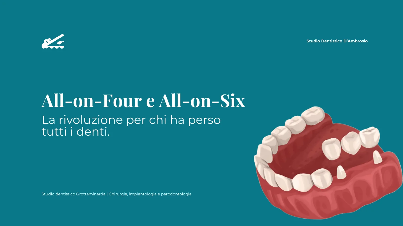 Pubblicità odontoiatrica color verde acqua con testo bianco e un modello 3D rosso di denti superiori e inferiori che utilizzano un ponte All-on-Six allineato.