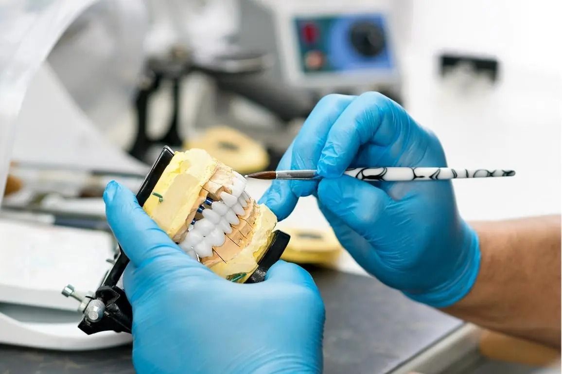 Sbiancamento dentale