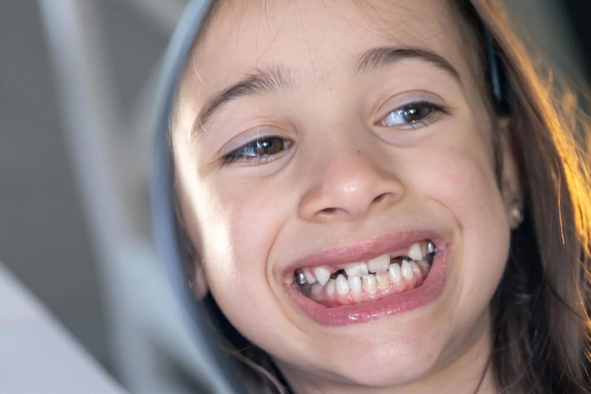 Bambino sorridente che mostra i denti incisivi mancanti allo specchio, con uno sfondo grigio sfocato.