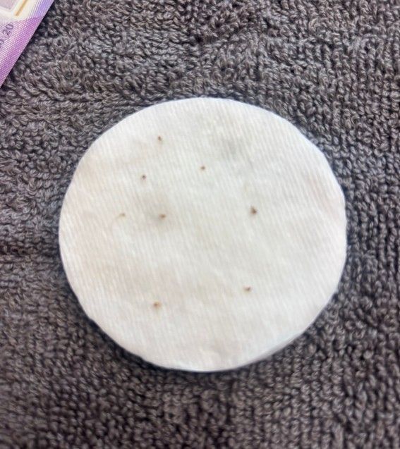 Cotton pad showing blackheads extracted during a professional facial extraction treatment at The Skin Studio, Nottingham