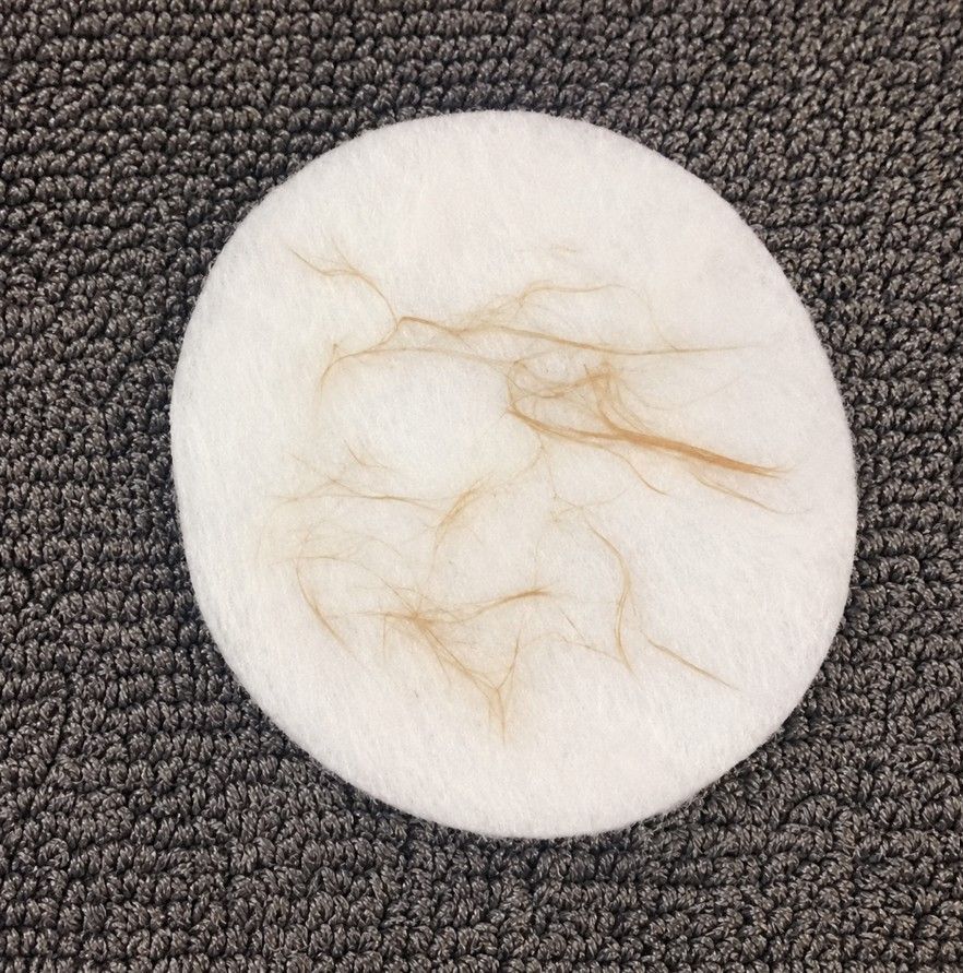 A close up of the fine hairs removed from a client's face