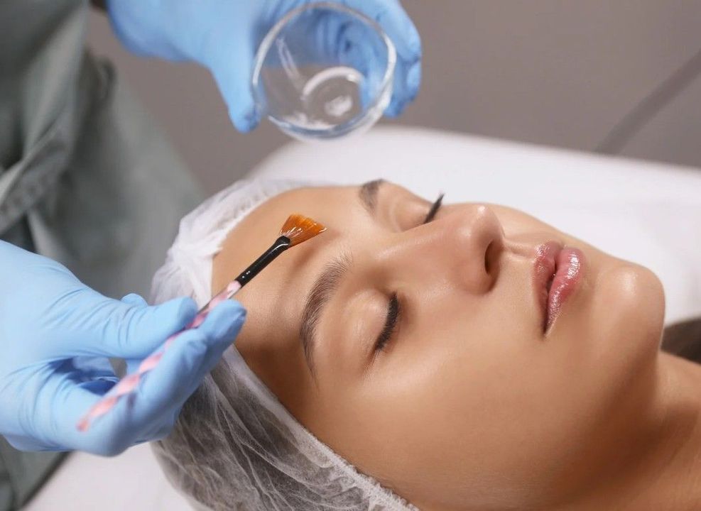 The Skin Studio applying a chemical peel to a client's face in Nottingham
