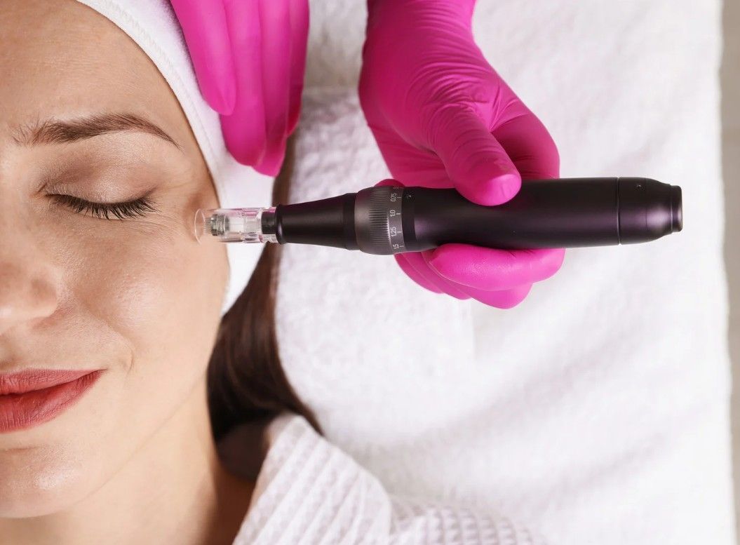 The Skin Studio performing microneedling for a client in Nottingham