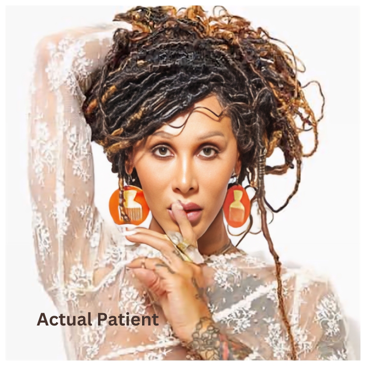 Feel more like a woman with a facial feminization surgery
