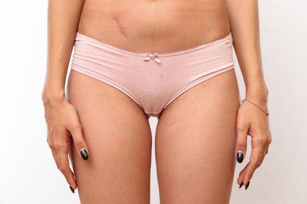 Vaginal Rejuvenation in Beverly Hills