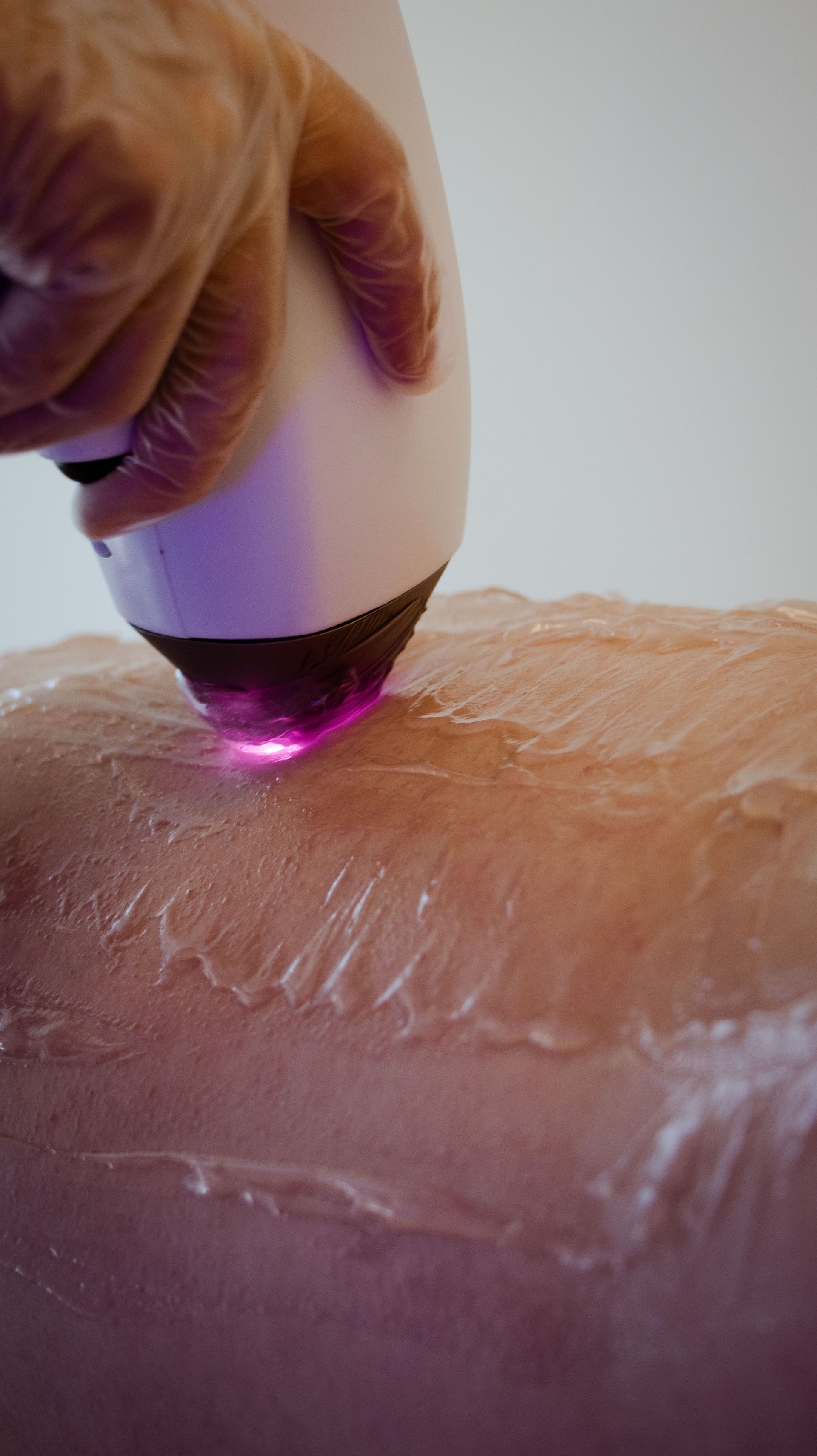 Cosmetic treatment applied to a woman’s lips with gloved hands in a spa setting