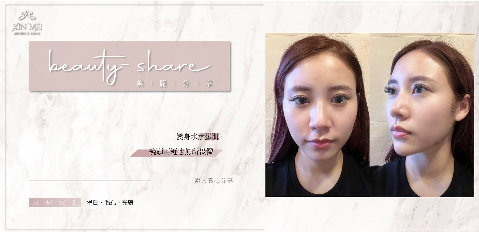 【分享】素人真心分享 |皮秒雷射