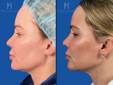 Before and after image