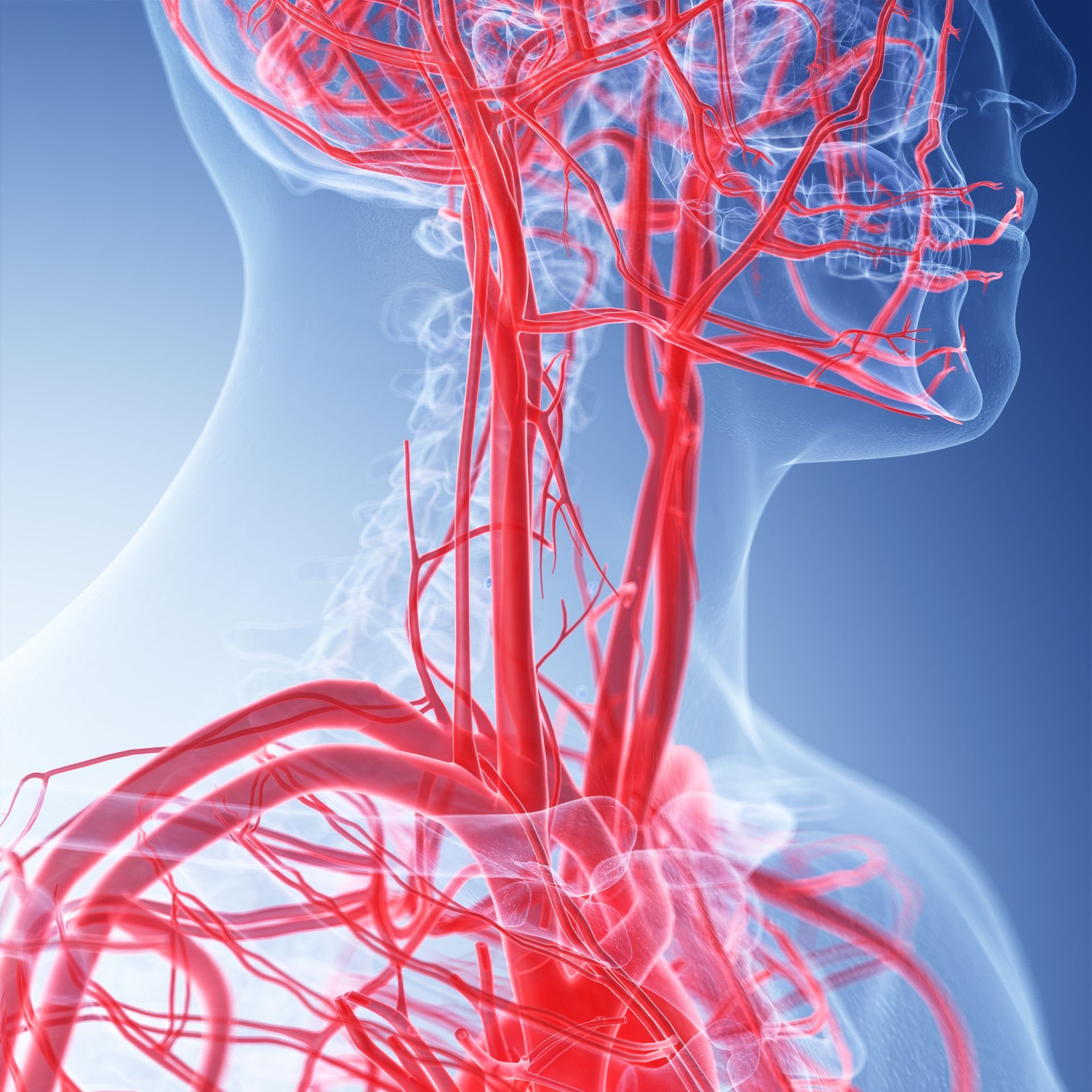 Ultrassom doppler de carótidas e vertebrais em Maringá Ultrassom doppler de carótidas e vertebrais em Maringá