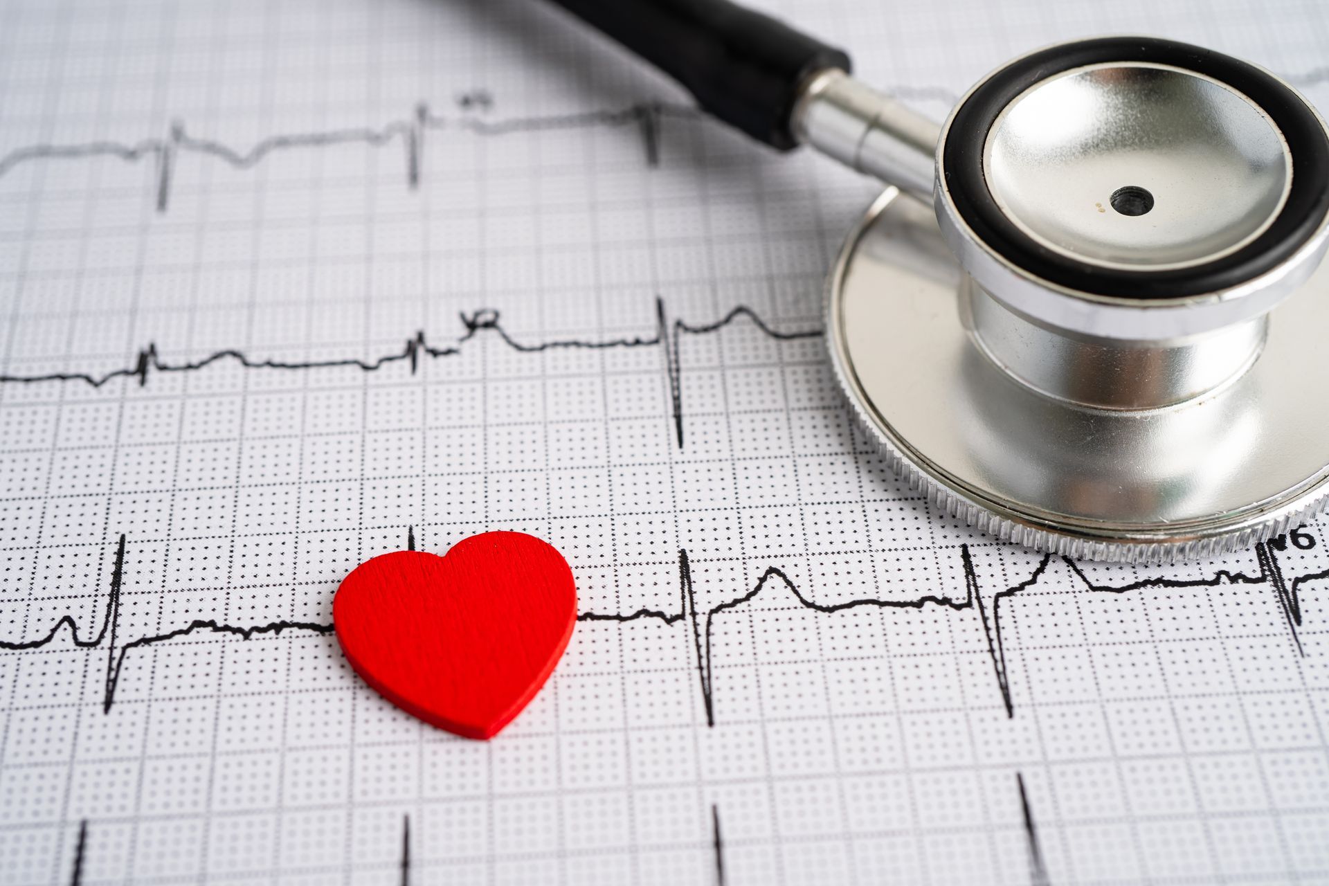 Eletrocardiograma em Maringá Eletrocardiograma em Maringá