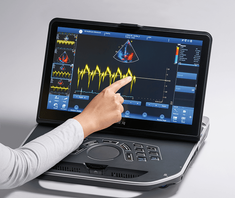Ecocardiografia em Maringá Ecocardiografia em Maringá