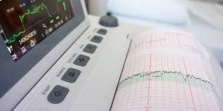 EKG