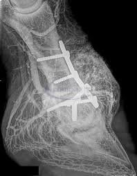 Lastra radiografia