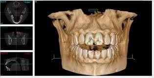 Panoramica dentale
