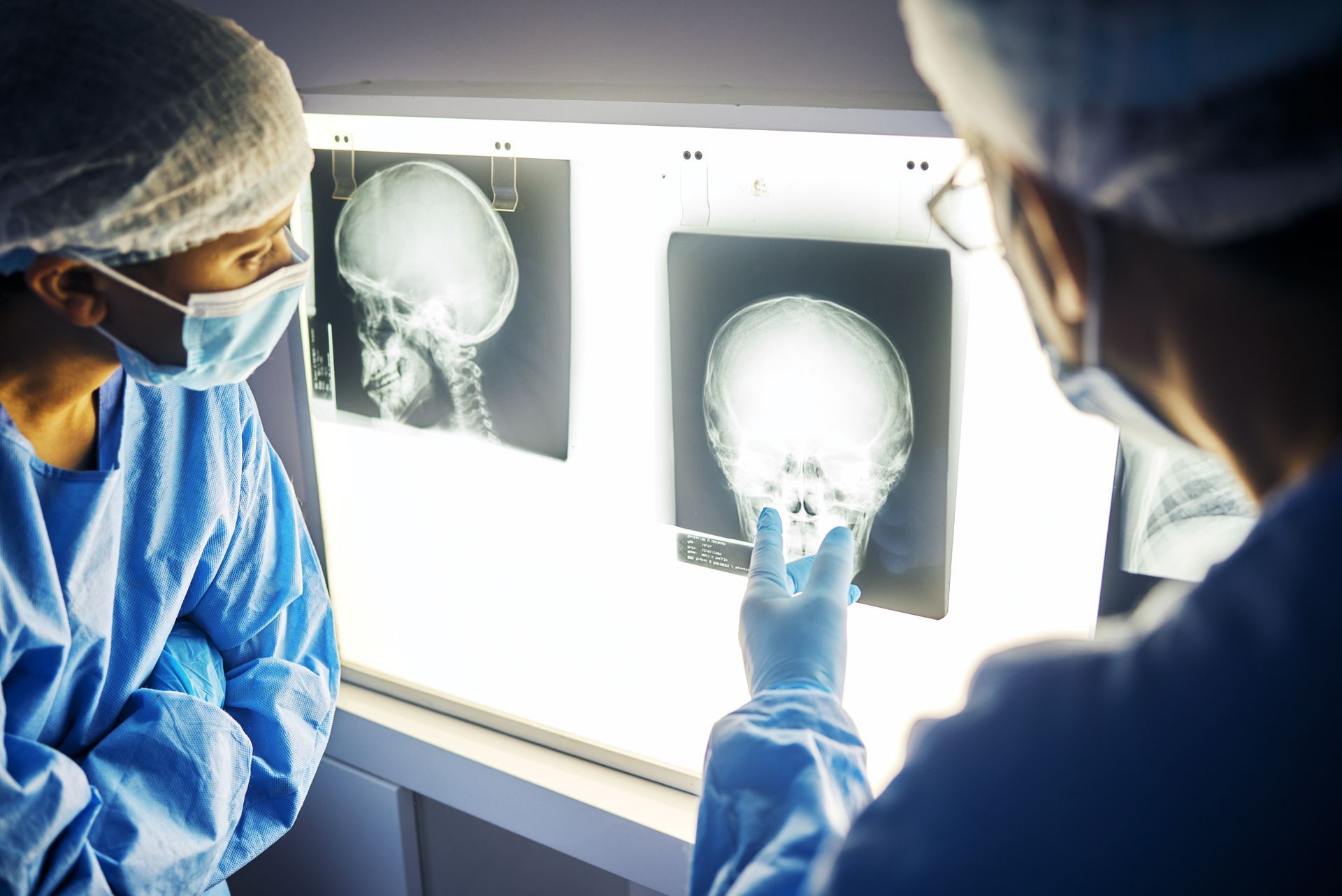 Medical professionals reviewing brain X-rays on a lightboard in a clinical setting.