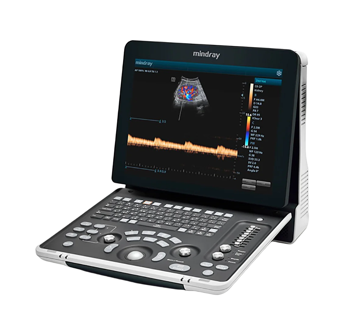 Mindray Z60