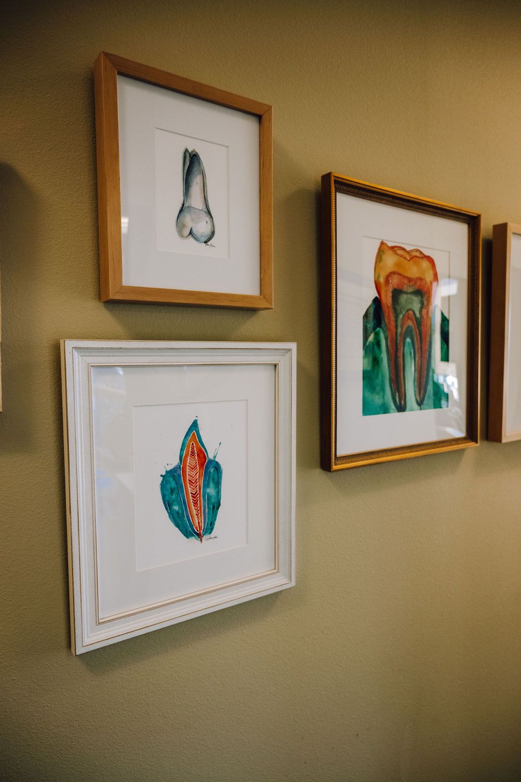 Three framed watercolor paintings of teeth on a tan wall; a mix of grayscale and colorful illustrations.