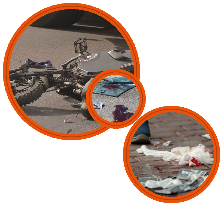 Crashed e-bike lying on the road with visible damage, part of the crash scene evidence students investigate anBlood-stained medical waste and bandages left at the scene, part of the crash scene evidence students investigate