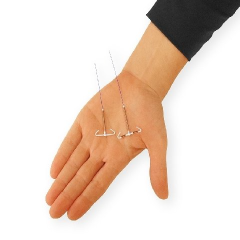 T shape IUD Gold hormon free
