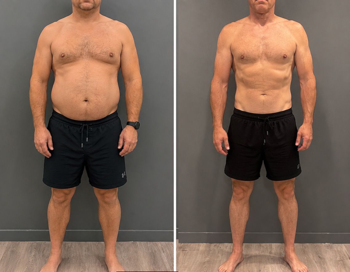 Foto's naast elkaar van de torso van een persoon in een zwarte korte broek, waarbij de rechterfoto een slankere taille laat zien.