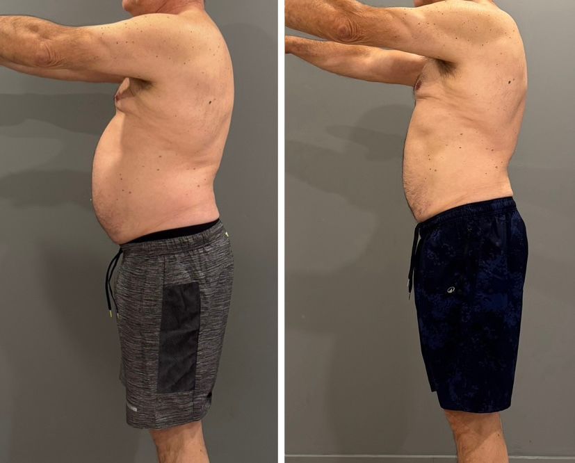 Voor en na foto van vrouw 40+ die personal training heeft gedaan