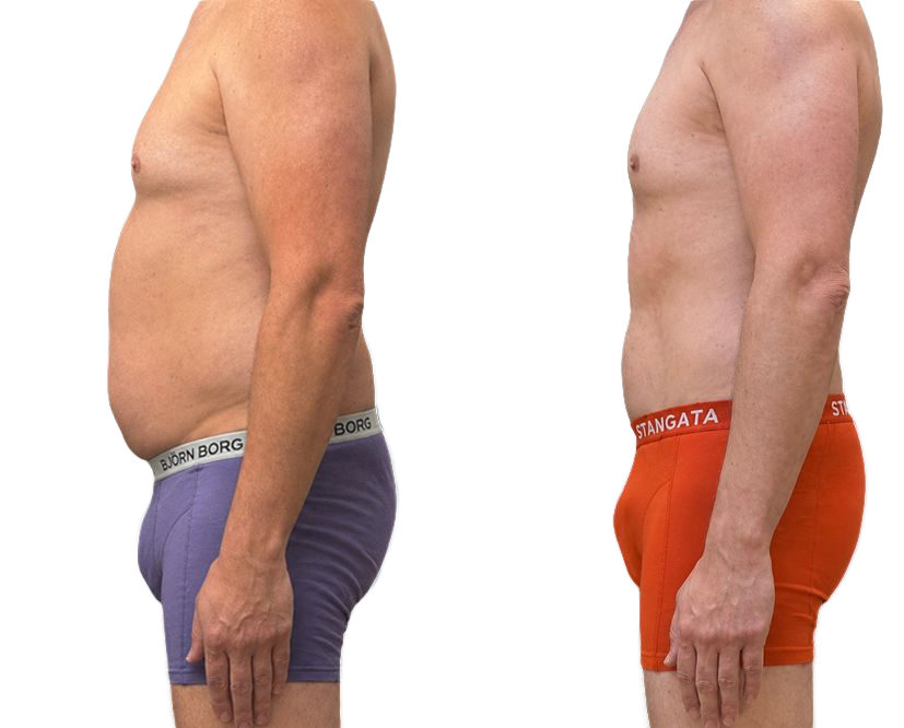 Vergelijking van een man in een paarse en oranje boxershort, gezien vanaf de zijkant, waarbij zijn houding en lichaamsprofiel zichtbaar zijn.