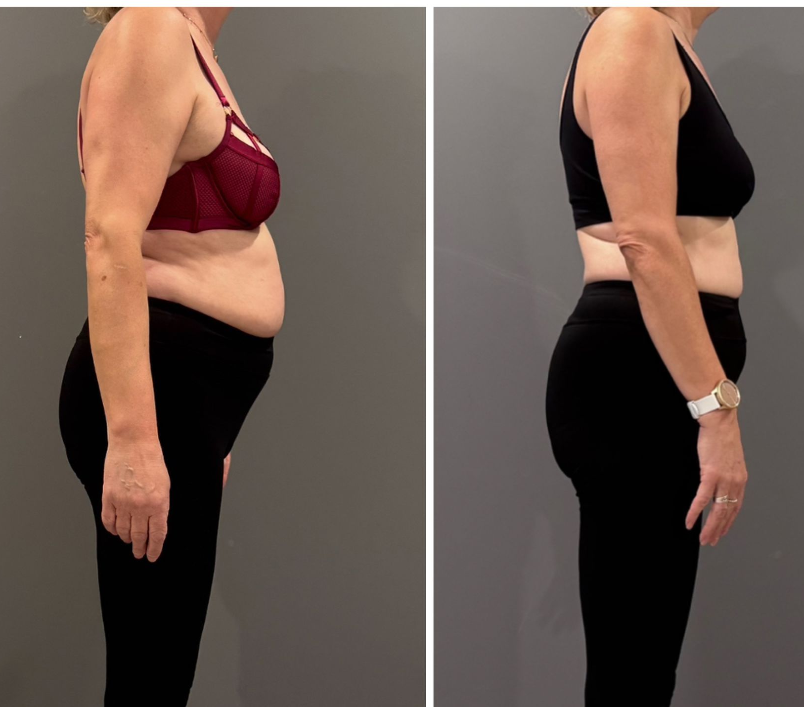 Personal training Apeldoorn
