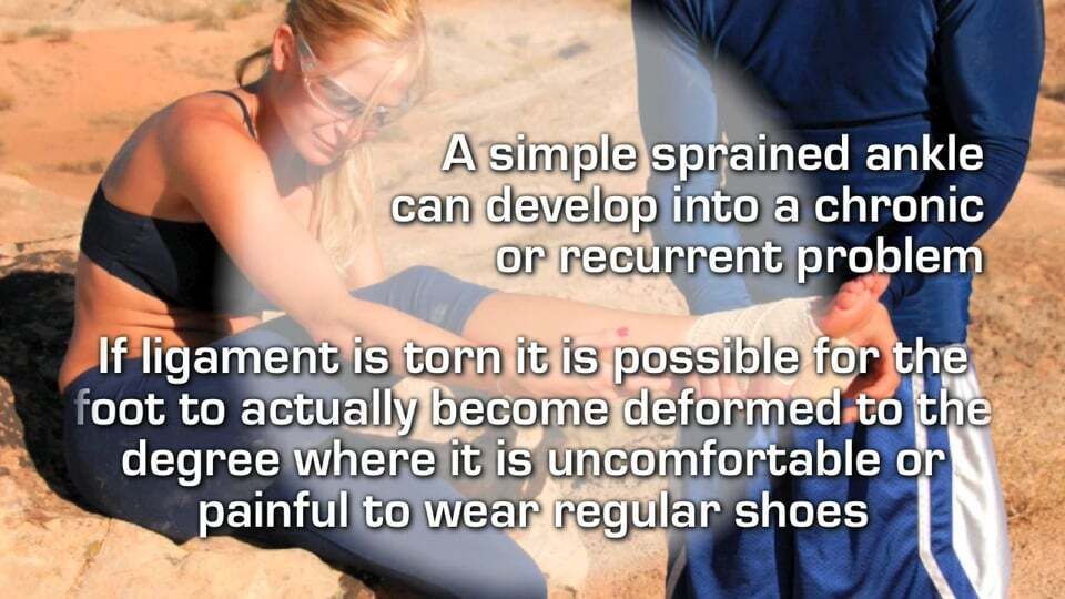 Ankle Sprains