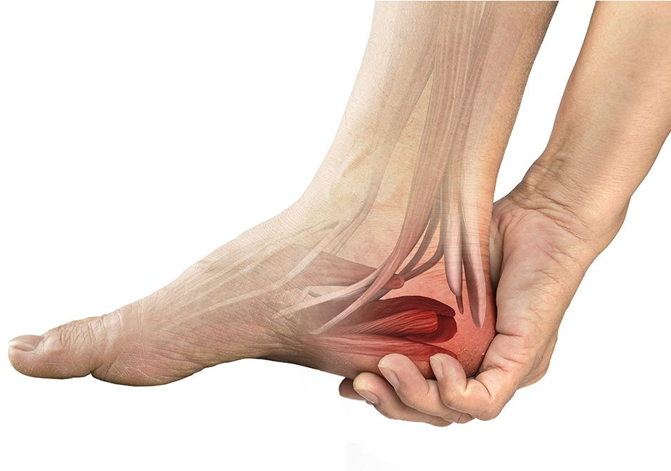 Heel Pain