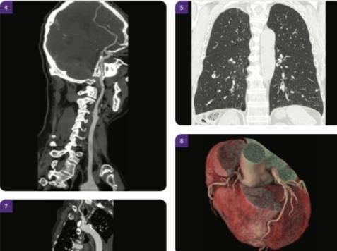 A ct scan of a person 's head , chest , and heart