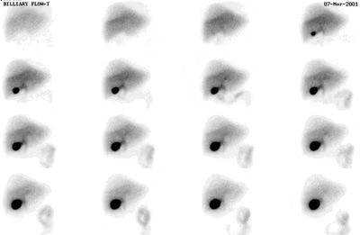 A row of black and white images of a person 's eyes on a white background.