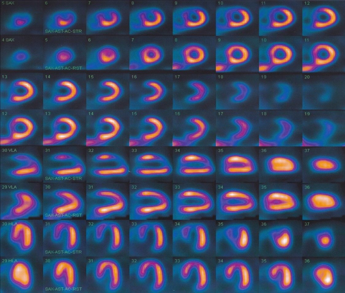 A collage of images of a person 's heart