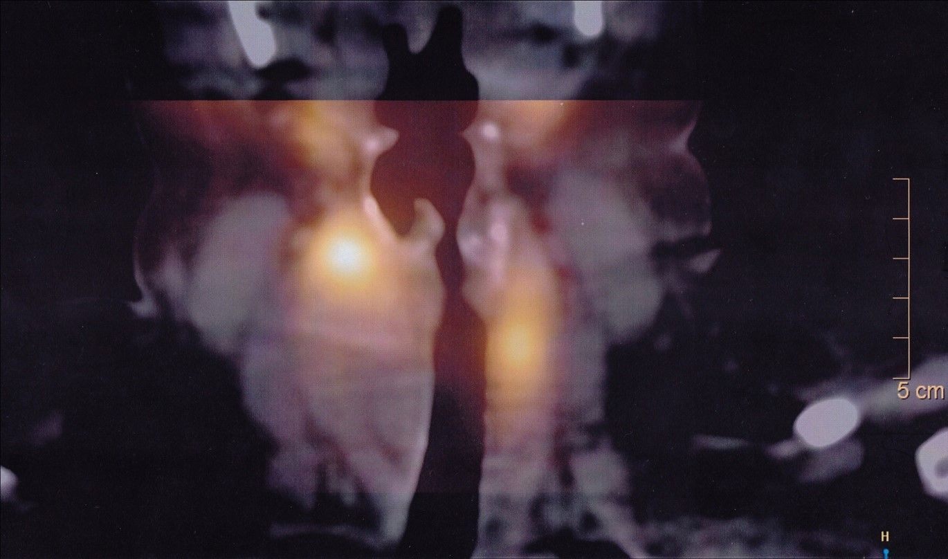A silhouette of a person in a dark room with a bar on the bottom right