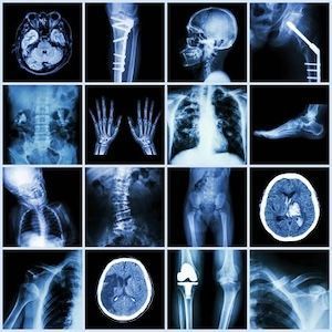 A collage of x-rays of different parts of the human body.