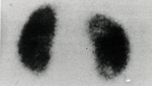 A black and white photo of two black spots on a white surface.