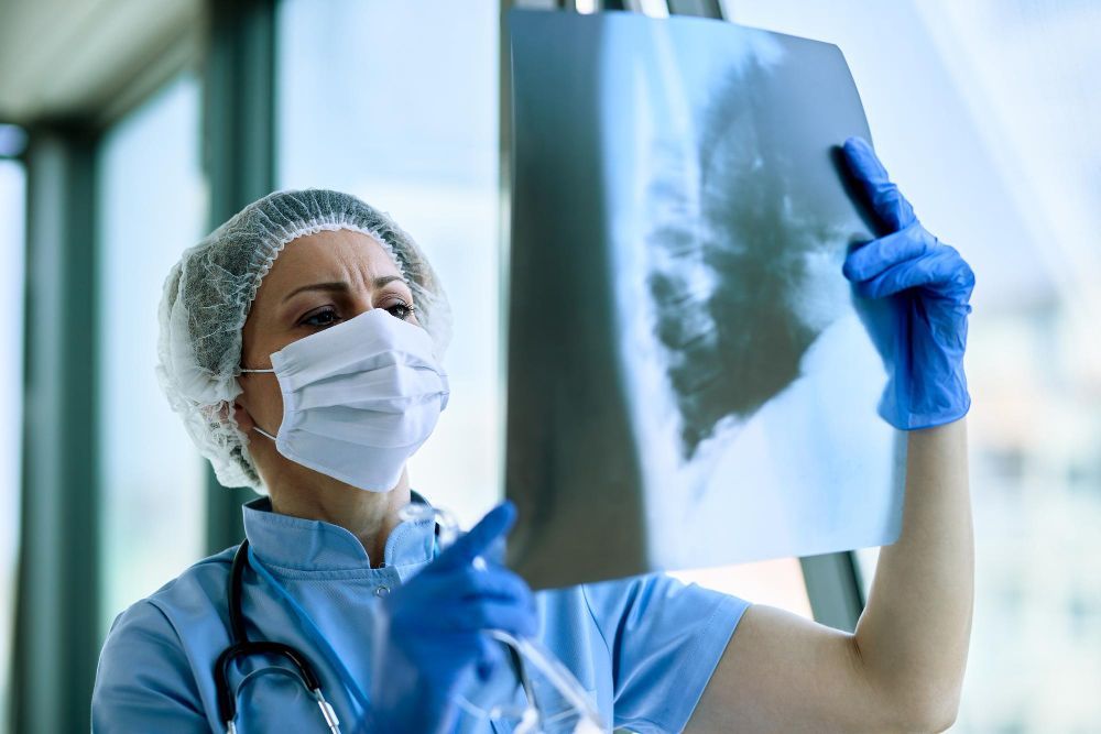 A female doctor wearing a mask and gloves is looking at an x-ray.
