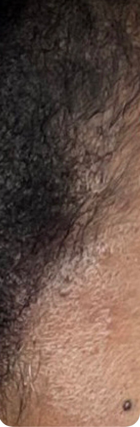 micropigmentation treatment result Clinton Township