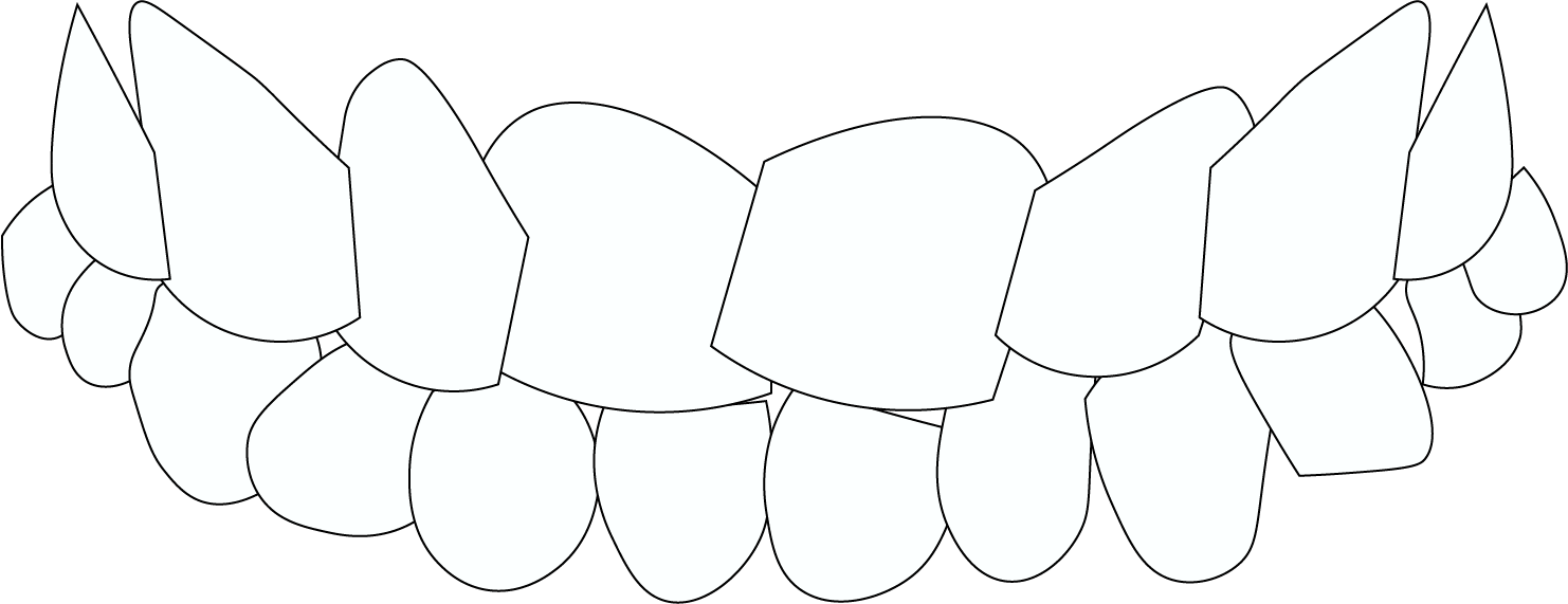 Mishapen Teeth