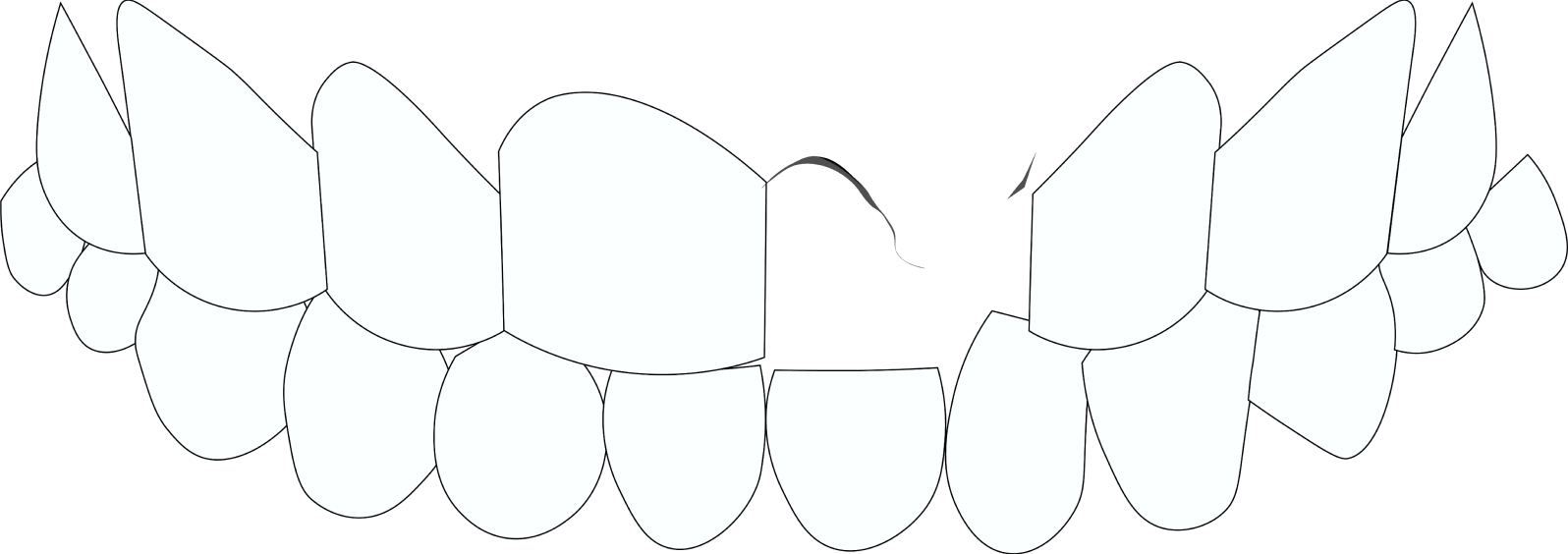 Tooth Loss Decay