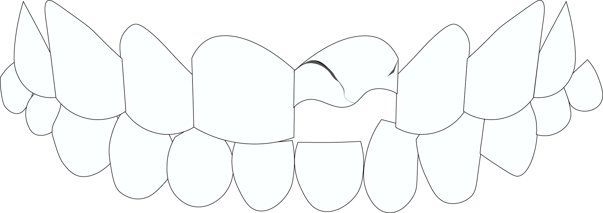 Painful toothaches